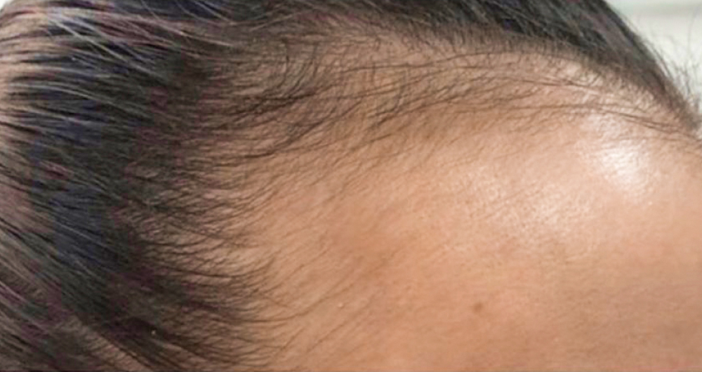 Восстановление волос Regenera