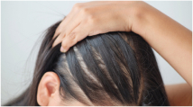 Мезотерапия для волос: экспресс-помощь при выпадении, перхоти, секущихся кончиках